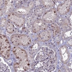 Invitrogen TMEM263 Polyclonal Antibody 100 &mu;L; Unconjugated:Antibodies,
