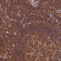Invitrogen STOML1 Polyclonal Antibody 100 &mu;L; Unconjugated:Antibodies,