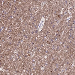 Invitrogen TMEM138 Polyclonal Antibody 100 &mu;L | Buy Online | Invitrogen&trade; | Fisher Scientific