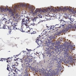 Invitrogen TMEM138 Polyclonal Antibody 100 &mu;L | Buy Online | Invitrogen&trade; | Fisher Scientific