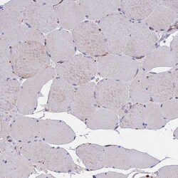 Invitrogen TMEM138 Polyclonal Antibody 100 &mu;L | Buy Online | Invitrogen&trade; | Fisher Scientific