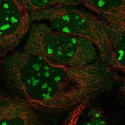 Invitrogen INTS4 Polyclonal Antibody 100 &mu;L; Unconjugated:Antibodies,