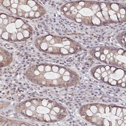Invitrogen INTS4 Polyclonal Antibody 100 &mu;L; Unconjugated:Antibodies,
