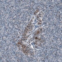 Invitrogen SCD5 Polyclonal Antibody 100 &mu;L | Buy Online | Invitrogen&trade; | Fisher Scientific
