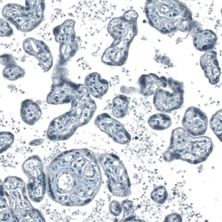 Invitrogen SCD5 Polyclonal Antibody 100 &mu;L | Buy Online | Invitrogen&trade; | Fisher Scientific