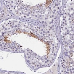 Invitrogen KIAA1683 Polyclonal Antibody 100 &mu;L; Unconjugated:Antibodies,