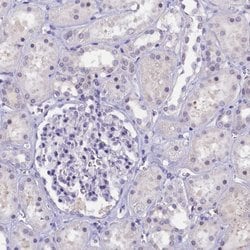 Invitrogen KIAA1683 Polyclonal Antibody 100 &mu;L; Unconjugated:Antibodies,