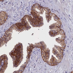 Invitrogen COL19A1 Polyclonal Antibody 100 &mu;L | Buy Online | Invitrogen&trade; | Fisher Scientific