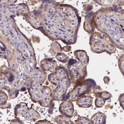 Invitrogen NAIP Polyclonal Antibody 100 &mu;L | Buy Online | Invitrogen&trade; | Fisher Scientific