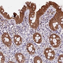 Invitrogen C21orf7 Polyclonal Antibody 100 &mu;L; Unconjugated:Antibodies,