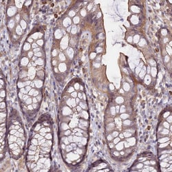 Invitrogen NNT1 Polyclonal Antibody 100 &mu;L; Unconjugated:Antibodies,