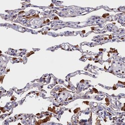 Invitrogen CRIP1 Polyclonal Antibody 100 &mu;L; Unconjugated:Antibodies,