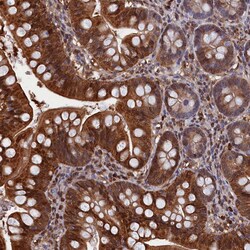 Invitrogen CRIP1 Polyclonal Antibody 100 &mu;L; Unconjugated:Antibodies,