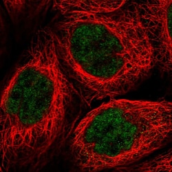 Invitrogen PRELID2 Polyclonal Antibody 100 &mu;L; Unconjugated:Antibodies,