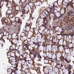 Invitrogen PRELID2 Polyclonal Antibody 100 &mu;L; Unconjugated:Antibodies,