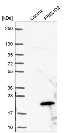Invitrogen PRELID2 Polyclonal Antibody 100 &mu;L; Unconjugated:Antibodies,