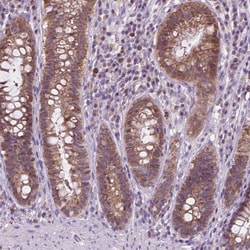 Invitrogen TTC9B Polyclonal Antibody 100 &mu;L; Unconjugated:Antibodies,