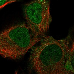 Invitrogen LYPD5 Polyclonal Antibody 100 &mu;L; Unconjugated:Antibodies,