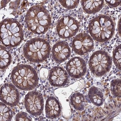Invitrogen LYPD5 Polyclonal Antibody 100 &mu;L; Unconjugated:Antibodies,