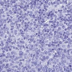 Invitrogen TEX101 Polyclonal Antibody 100 &mu;L; Unconjugated:Antibodies,