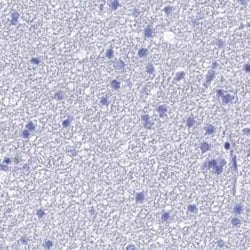 Invitrogen TEX101 Polyclonal Antibody 100 &mu;L; Unconjugated:Antibodies,