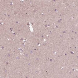 Invitrogen CCDC114 Polyclonal Antibody 100 &mu;L; Unconjugated:Antibodies,