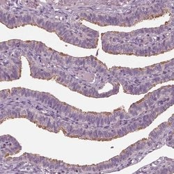 Invitrogen CCDC114 Polyclonal Antibody 100 &mu;L; Unconjugated:Antibodies,