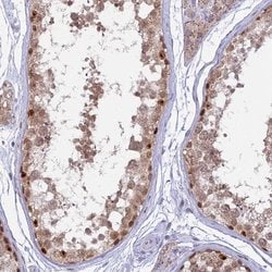 Invitrogen CENPV Polyclonal Antibody 100 &mu;L | Buy Online | Invitrogen&trade; | Fisher Scientific