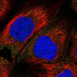 Invitrogen ZDHHC1 Polyclonal Antibody 100 &mu;L; Unconjugated:Antibodies,