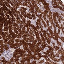 Invitrogen N6AMT2 Polyclonal Antibody 100 &mu;L | Buy Online | Invitrogen&trade; | Fisher Scientific