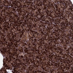 Invitrogen CACTIN Polyclonal Antibody 100 &mu;L; Unconjugated:Antibodies,