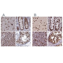 Invitrogen HDGFRP2 Polyclonal Antibody 100 &mu;L; Unconjugated:Antibodies,