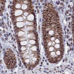 Invitrogen HDGFRP2 Polyclonal Antibody 100 &mu;L; Unconjugated:Antibodies,