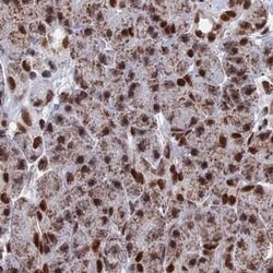 Invitrogen HDGFRP2 Polyclonal Antibody 100 &mu;L; Unconjugated:Antibodies,