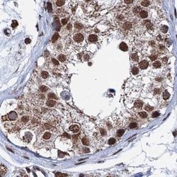 Invitrogen HDGFRP2 Polyclonal Antibody 100 &mu;L; Unconjugated:Antibodies,