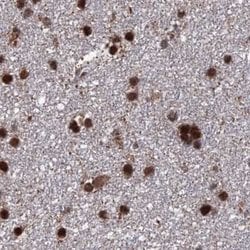 Invitrogen HDGFRP2 Polyclonal Antibody 100 &mu;L; Unconjugated:Antibodies,