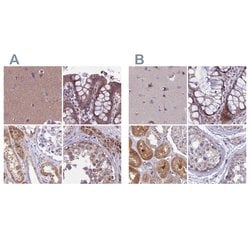 Invitrogen DUS2L Polyclonal Antibody 100 &mu;L; Unconjugated:Antibodies,