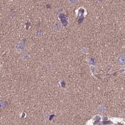 Invitrogen DUS2L Polyclonal Antibody 100 &mu;L; Unconjugated:Antibodies,