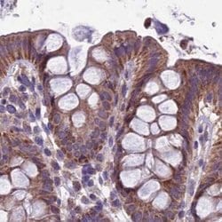 Invitrogen DUS2L Polyclonal Antibody 100 &mu;L; Unconjugated:Antibodies,