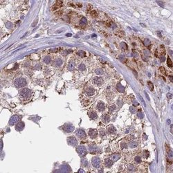 Invitrogen DUS2L Polyclonal Antibody 100 &mu;L; Unconjugated:Antibodies,