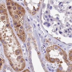 Invitrogen DUS2L Polyclonal Antibody 100 &mu;L; Unconjugated:Antibodies,