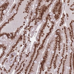 Invitrogen H3F3A Polyclonal Antibody 100 &mu;L | Buy Online | Invitrogen&trade; | Fisher Scientific
