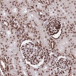 Invitrogen H3F3A Polyclonal Antibody 100 &mu;L | Buy Online | Invitrogen&trade; | Fisher Scientific