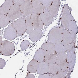 Invitrogen H3F3A Polyclonal Antibody 100 &mu;L | Buy Online | Invitrogen&trade; | Fisher Scientific
