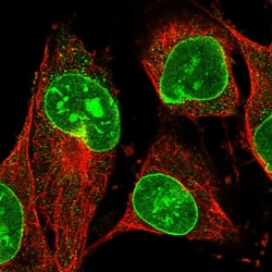 Invitrogen TCHHL1 Polyclonal Antibody 100 &mu;L; Unconjugated:Antibodies,