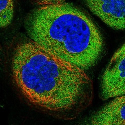 Invitrogen AdoHcyase 2 Polyclonal Antibody 100 &mu;L; Unconjugated:Antibodies,