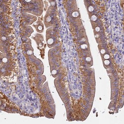 Invitrogen AdoHcyase 2 Polyclonal Antibody 100 &mu;L; Unconjugated:Antibodies,