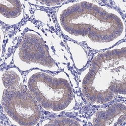 Invitrogen AdoHcyase 2 Polyclonal Antibody 100 &mu;L; Unconjugated:Antibodies,
