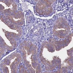 Invitrogen AdoHcyase 2 Polyclonal Antibody 100 &mu;L; Unconjugated:Antibodies,
