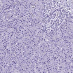 Invitrogen SLC7A9 Polyclonal Antibody 100 &mu;L; Unconjugated:Antibodies,